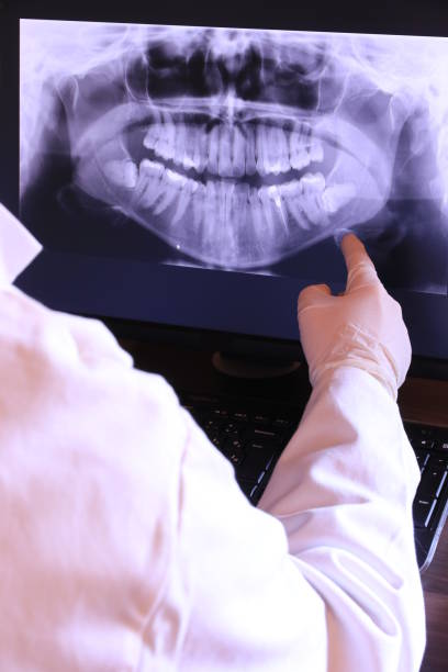Tooth Infection Emergency Dentist in MA